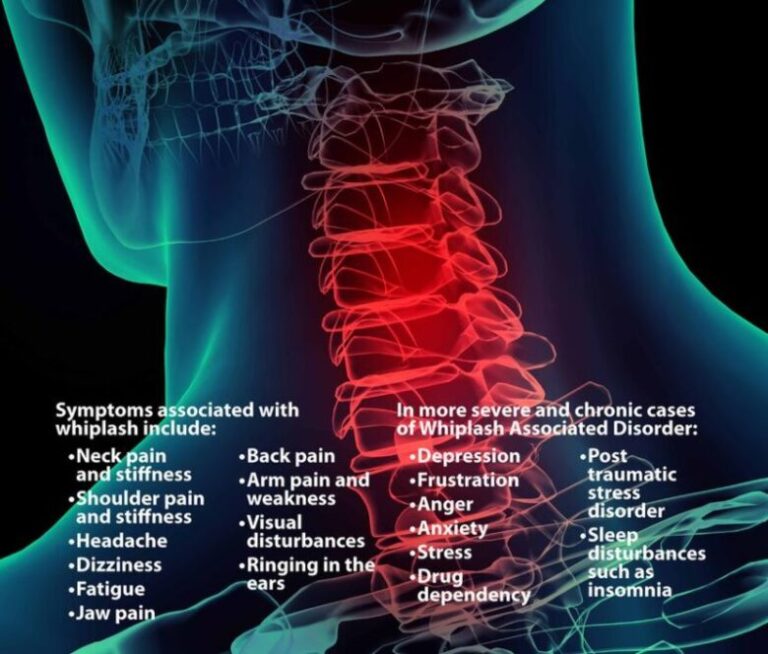 4 Amazing Exercises To Help You Recover From Whiplash - DemotiX