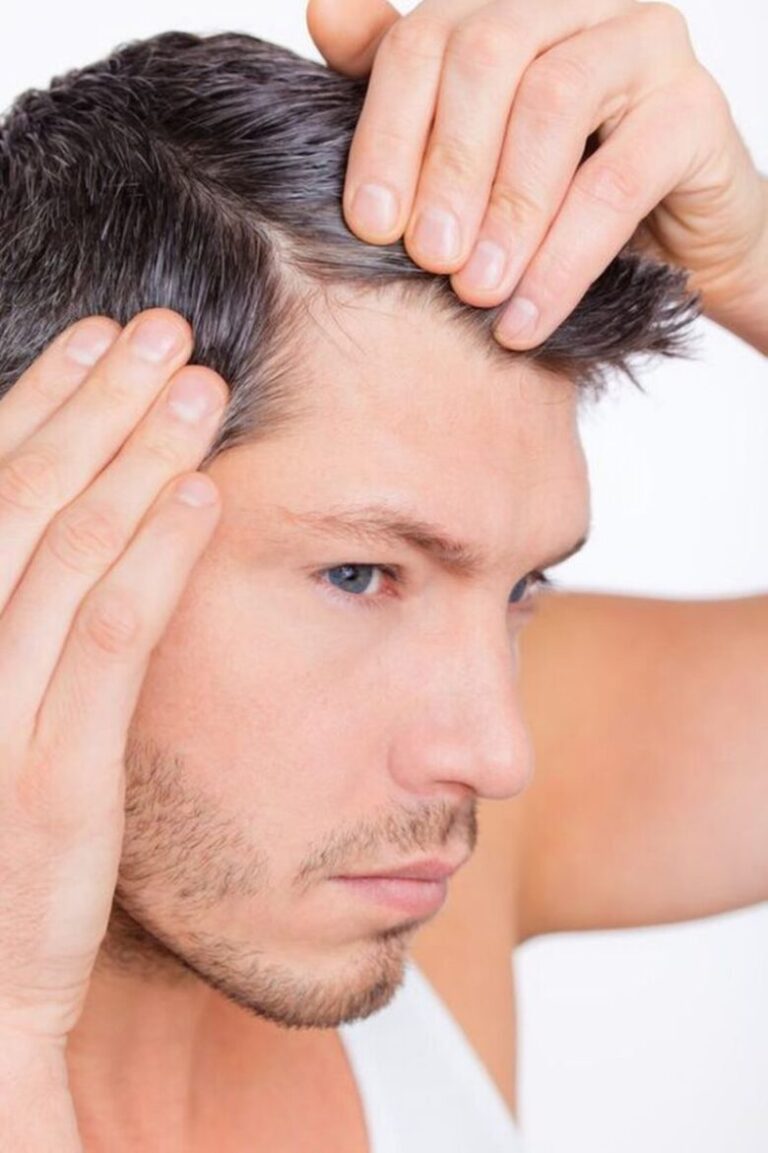 6-reasons-why-men-end-up-losing-their-hair-demotix