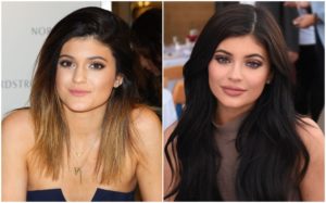 Kylie Jenner After Before Pictures Did She Do Surgery DemotiX