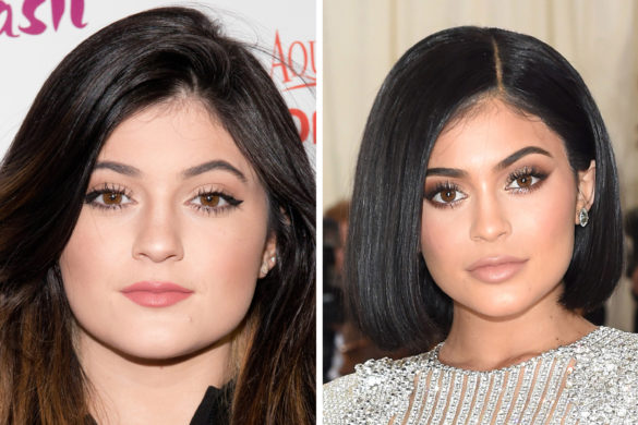 Kylie Jenner After Before Pictures Did She Do Surgery DemotiX