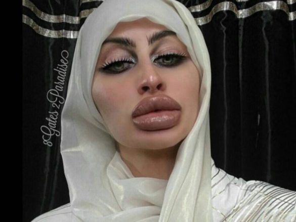 World Record Breaker: She Has the Biggest Lips in the World! - Demotix.com