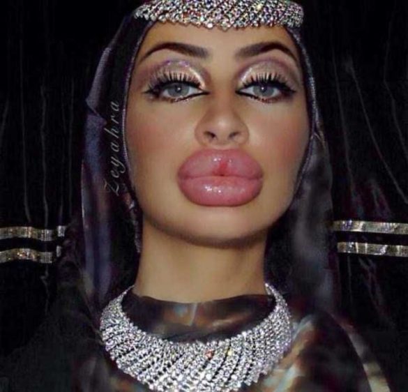 World Record Breaker: She Has the Biggest Lips in the World! - Demotix.com