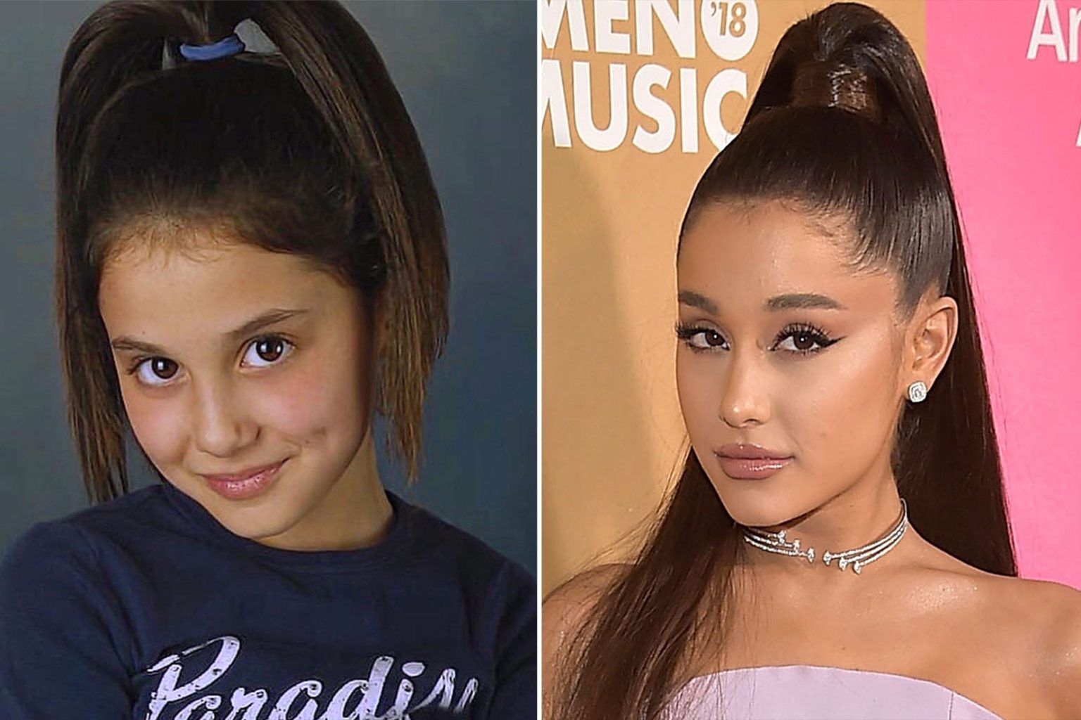 Ariana Grande Before & After: The Power of Plastic Surgery! - Demotix.com