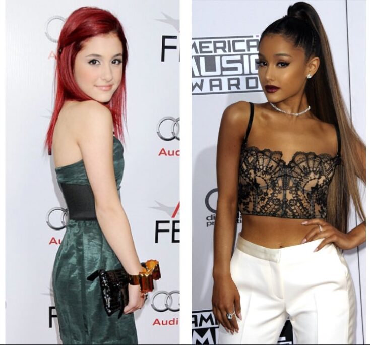 Ariana Grande Before & After The Power of Plastic Surgery! DemotiX