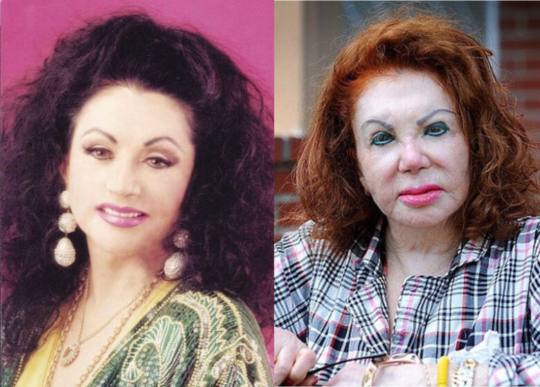Jackie Stallone plastic surgery before and after