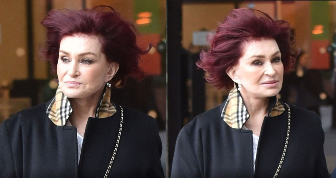 Sharon Osbourne's Face Is Swollen and She Is Suffering from Horrible