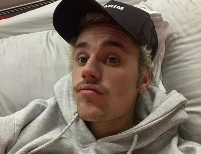 Justin Bieber Looks Unrecognizable While Treating Lyme Disease