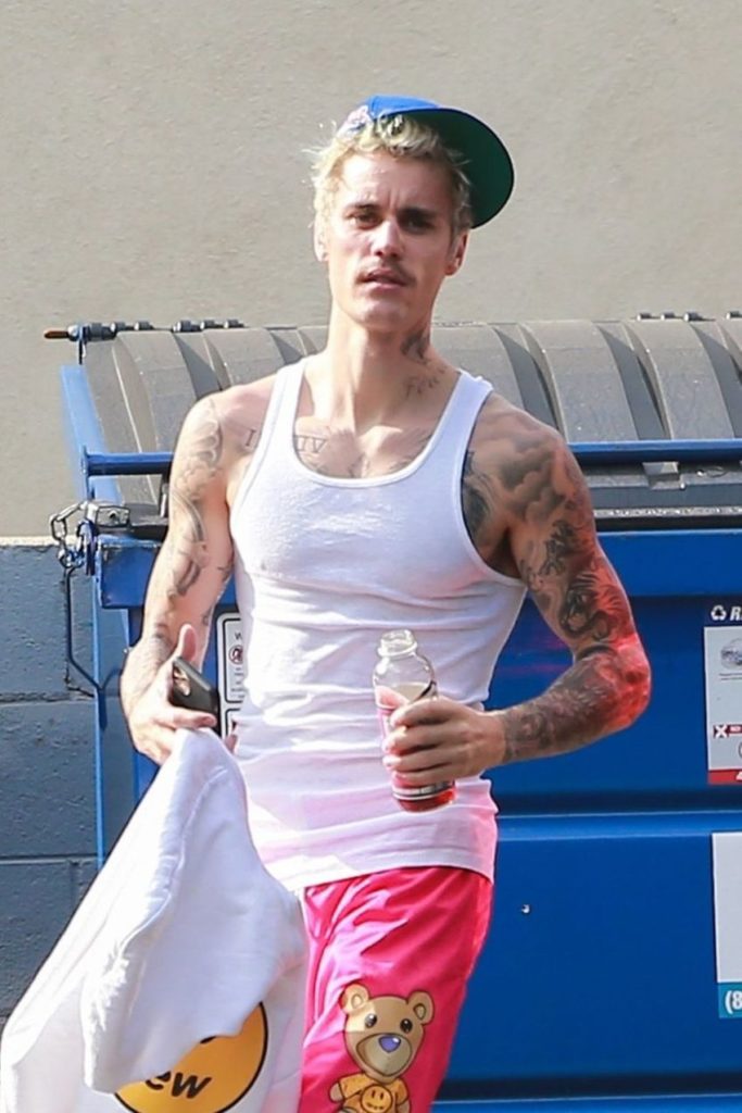 Justin Bieber Looks Unrecognizable While Treating Lyme Disease
