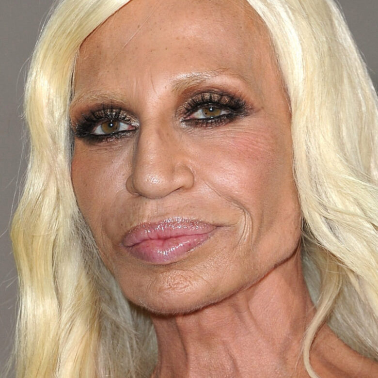 Is Donatella Versace the Biggest Celebrity Cosmetic Surgery Disaster ...