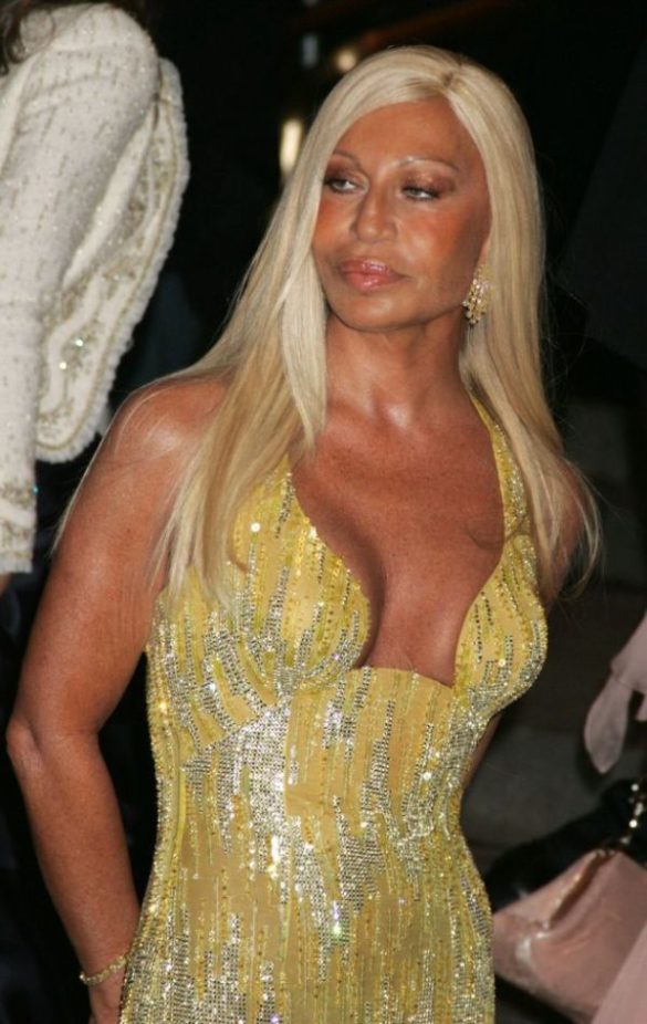 Is Donatella Versace The Biggest Celebrity Cosmetic Surgery Disaster 