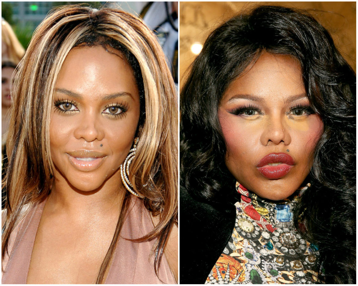 Lil' Kim Became Addicted to Plastic Surgeries After Several Repairs of