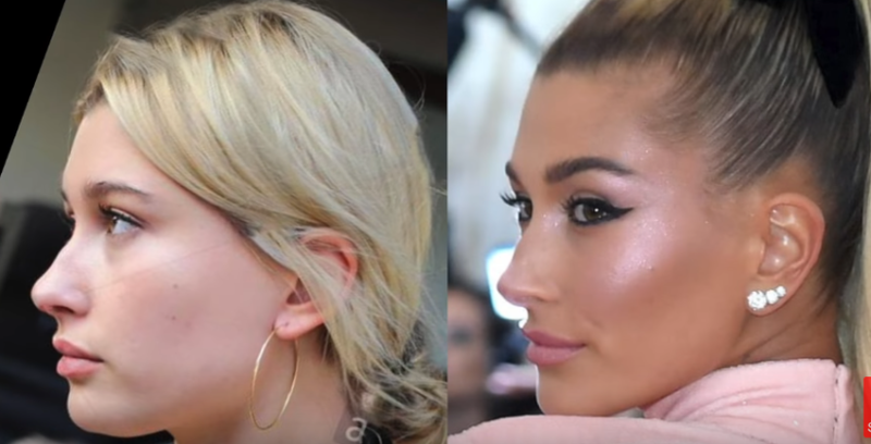 Did Hailey Baldwin Have Plastic Surgery Demotix 1827