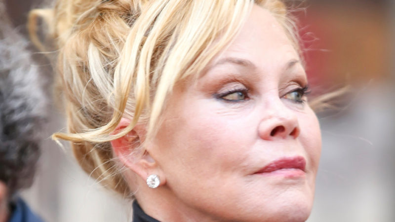 Melanie Griffith Can Barely Move Her Lips And Cheeks Demotix