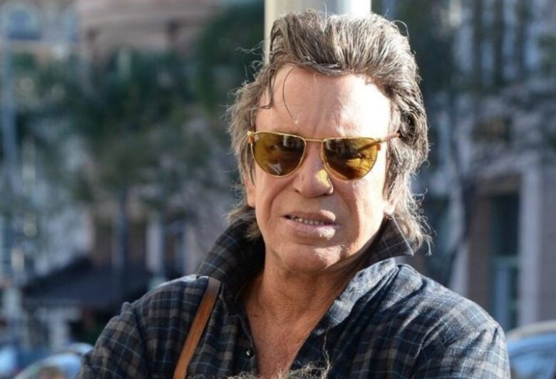 Mickey Rourke's Face Is Destroyed by Too Many Botched Plastic Surgeries