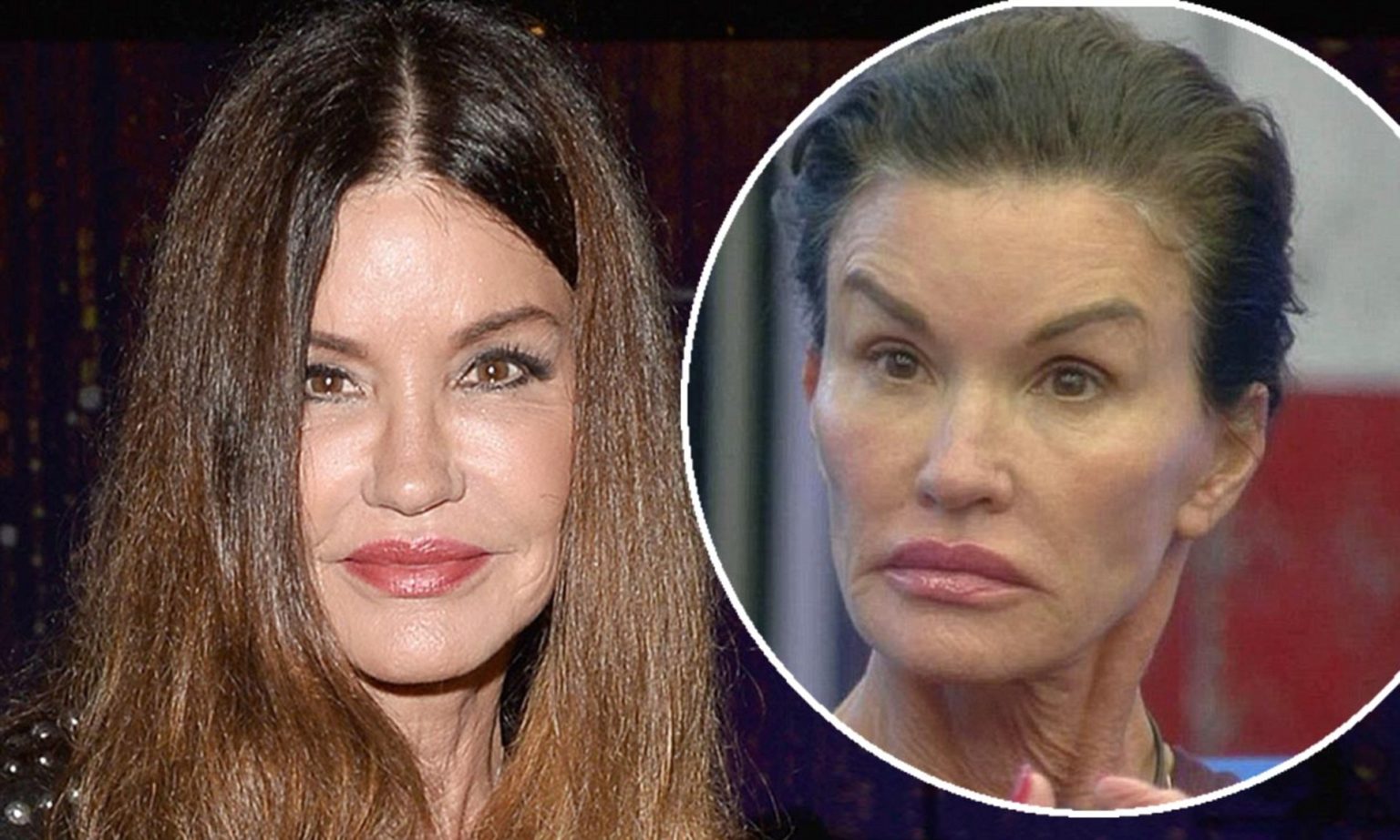 The First Supermodel Janice Dickinson Ruined Her Face With Plastic Surgery.