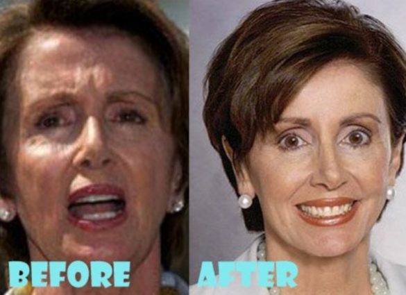 Has Nancy Pelosi Had Plastic Surgery? Before & After Pics - Demotix.com