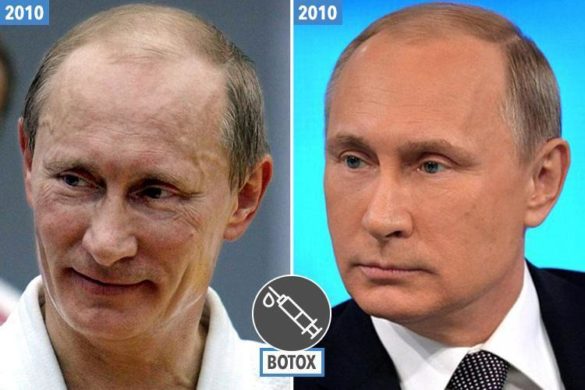 Plastic Surgeon Claims Putin Had These Surgeries