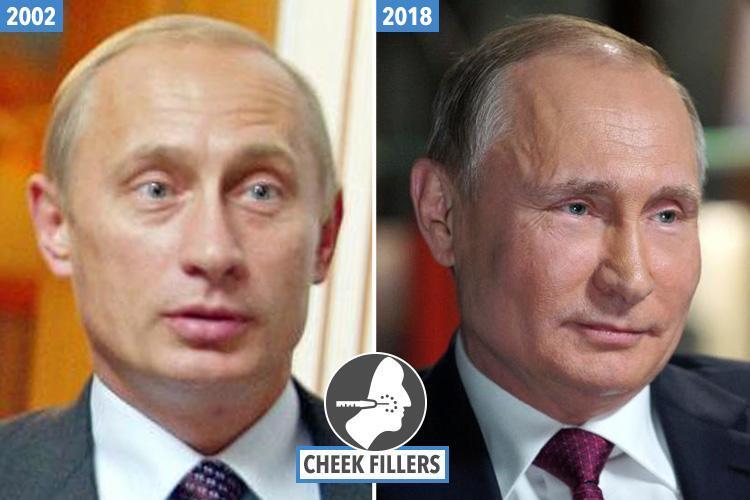 Путин в молодости и сейчас фото сравнить