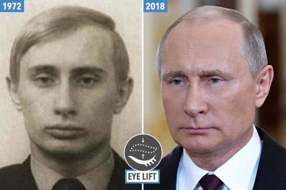 Plastic Surgeon Claims Putin Had These Surgeries Demotix