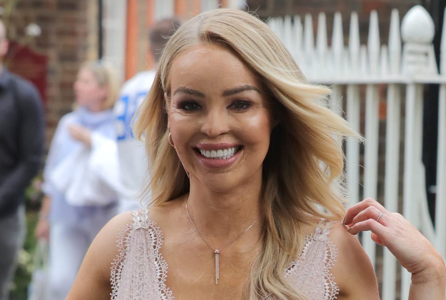 Katie Piper Fully Recovered After She Had Acid Thrown In Her Face Demotix 