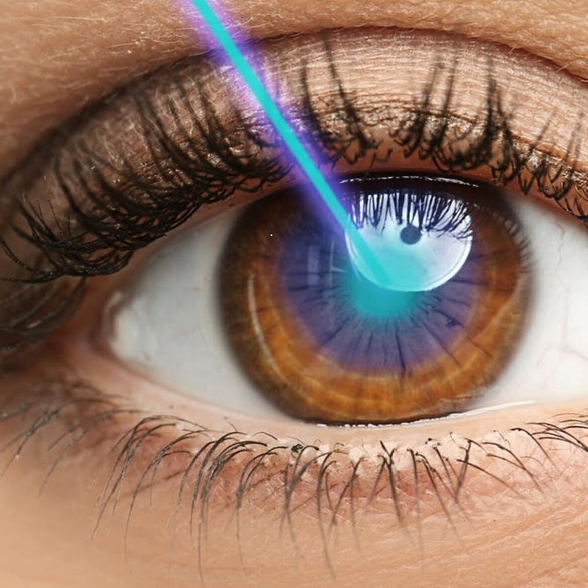 six-great-benefits-of-lasik-eye-surgery-demotix