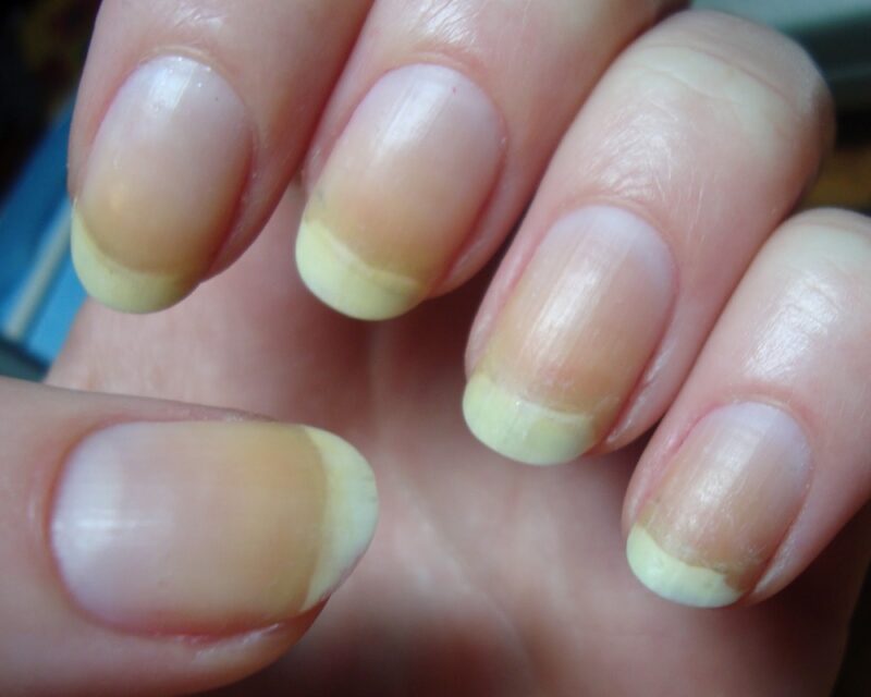 why-do-my-gel-nails-peel-off-demotix